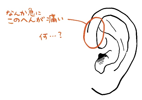 耳が痛いの図